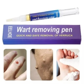 Wart Removal Pen Price in Pakistan